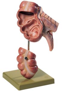 Model Appendix en Blinde Darm