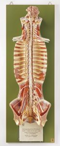 Anatomisch Model Ruggenmerg in Ruggenmergkanaal