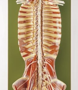 Anatomisch Model Ruggenmerg in Ruggenmergkanaal