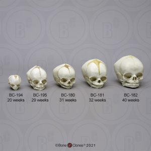 Modellenset Schedels Foetus, 5-delig