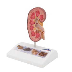 Niersteen Model