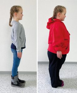Obesitas Simulatie Pak Kind