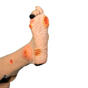 Oefenmodel Arterieel Vaatlijden