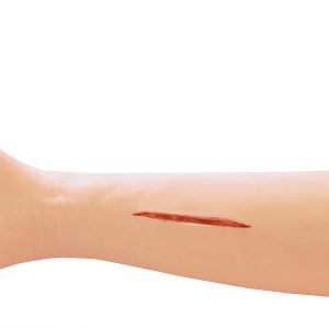Oefenmodel Hechtingen Arm