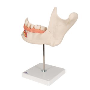 Onderkaak helft, 3x ware grootte