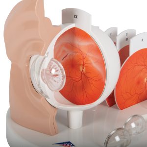 Oog met ziektebeelden