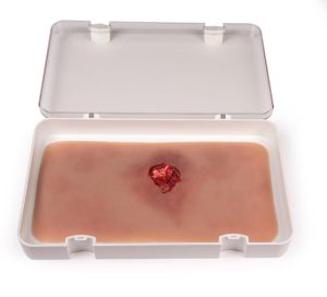 Open Breuk in Arm Wond Model met Bloedingsfunctie