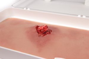 Open Breuk in Arm Wond Model met Bloedingsfunctie