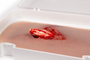 Open Breuk in Been Wond Model met Bloedingsfunctie
