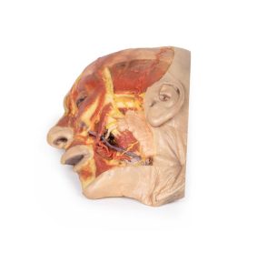 Oppervlakkige Dissectie Gezicht, 3D Print