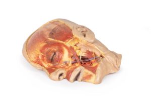 Oppervlakkige Dissectie Gezicht, 3D Print