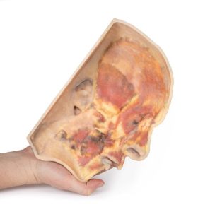 Oppervlakkige Dissectie Gezicht, 3D Print