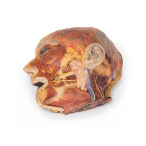 Oppervlakkige Gezichtszenuwen en Oorspeekselklier, 3D Print