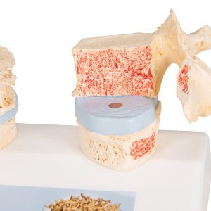 Osteoporose model