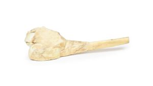 Osteosarcoom in Dijbeen, 3D Print