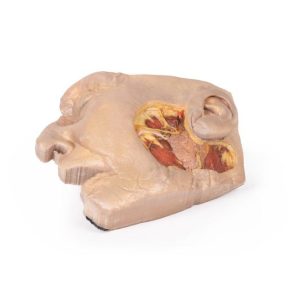 Parotisklier en Gezichtszenuw Dissectie, 3D Print