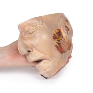 Parotisklier en Gezichtszenuw Dissectie, 3D Print