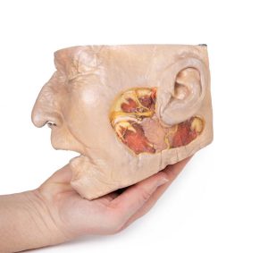 Parotisklier en Gezichtszenuw Dissectie, 3D Print