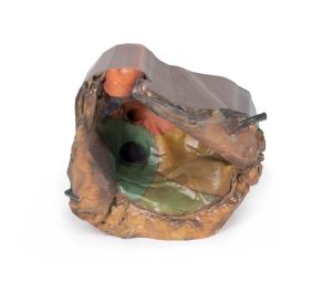 Pericardiale Ruimte, 3D Print