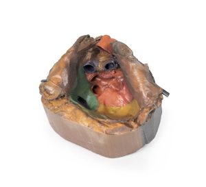 Pericardiale Ruimte, 3D Print