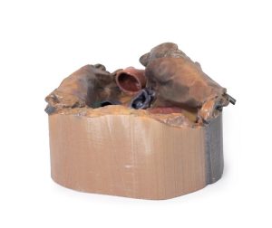 Pericardiale Ruimte, 3D Print