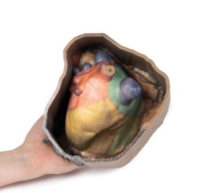 Pericardiale Ruimte, 3D Print