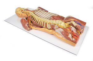 Posterieure Lichaamswand/Ventrale Diepe Dissectie, 3D Print