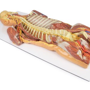 Posterieure Lichaamswand/Ventrale Diepe Dissectie, 3D Print
