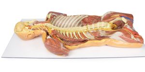 Posterieure Lichaamswand/Ventrale Diepe Dissectie, 3D Print