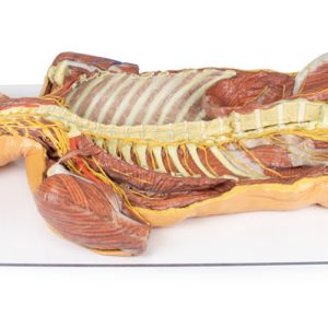 Posterieure Lichaamswand/Ventrale Diepe Dissectie, 3D Print