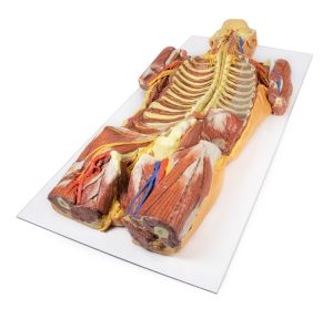 Posterieure Lichaamswand/Ventrale Diepe Dissectie, 3D Print