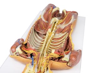 Posterieure Lichaamswand/Ventrale Diepe Dissectie, 3D Print