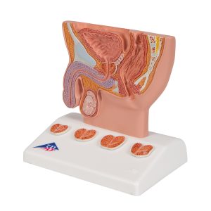 Prostaatmodel