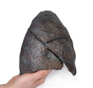 Rechter Long, hilum verwijderd, 3D Print