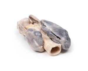 Retrosternaal Struma, 3D Print