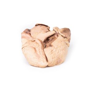 Reumatische Endocarditis, 3D Print
