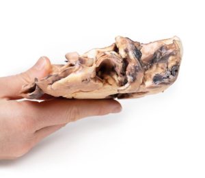 Reumatische Endocarditis, 3D Print