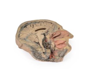 Sagittale Doorsnede Hoofd met diepe dissectie, 3D Print