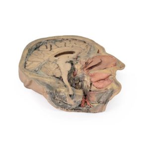 Sagittale Doorsnede Hoofd met diepe dissectie, 3D Print