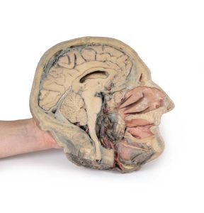 Sagittale Doorsnede Hoofd met diepe dissectie, 3D Print
