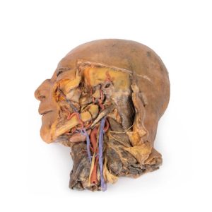 Sagittale Doorsnede Hoofd en Nek met Dissectie, 3D Print