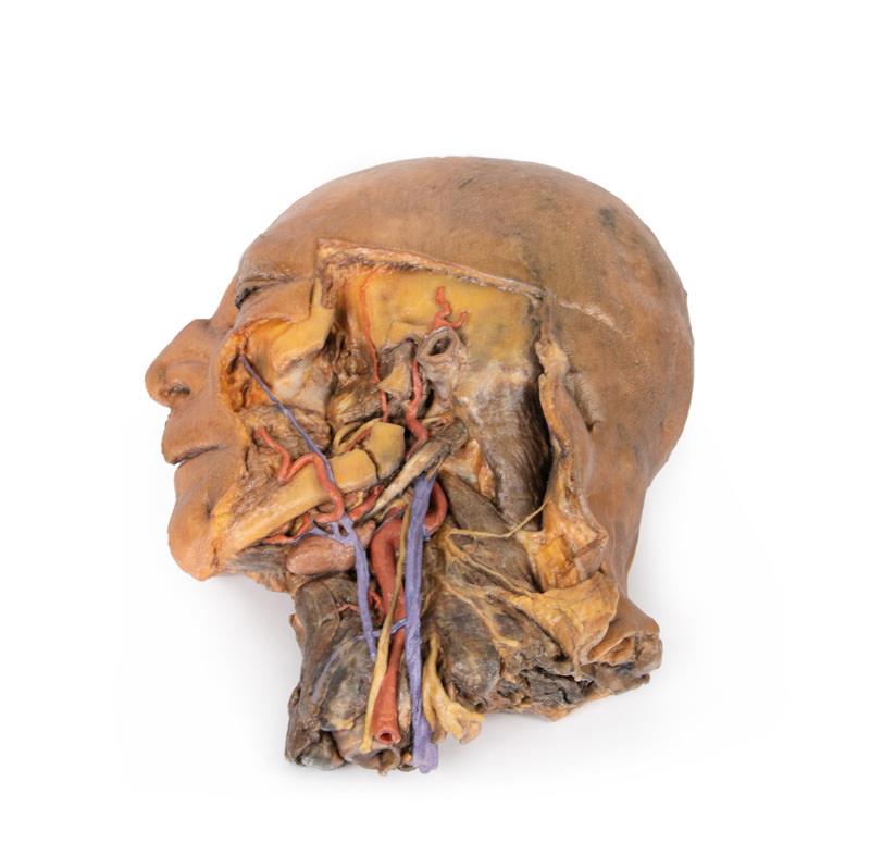 Sagittale Doorsnede Hoofd en Nek met Dissectie, 3D Print