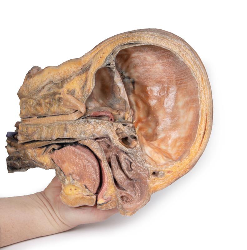Sagittale Doorsnede Hoofd en Nek met Dissectie, 3D Print