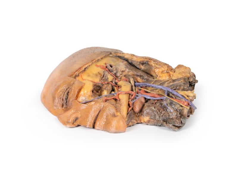 Sagittale Doorsnede Hoofd en Nek met Dissectie, 3D Print