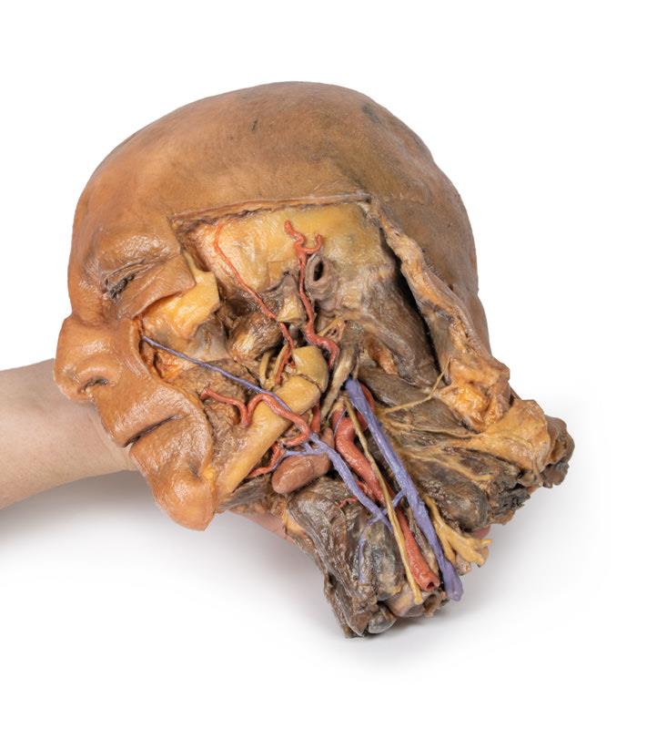 Sagittale Doorsnede Hoofd en Nek met Dissectie, 3D Print