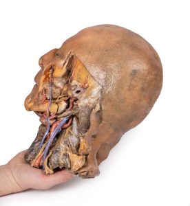 Sagittale Doorsnede Hoofd en Nek met Dissectie, 3D Print