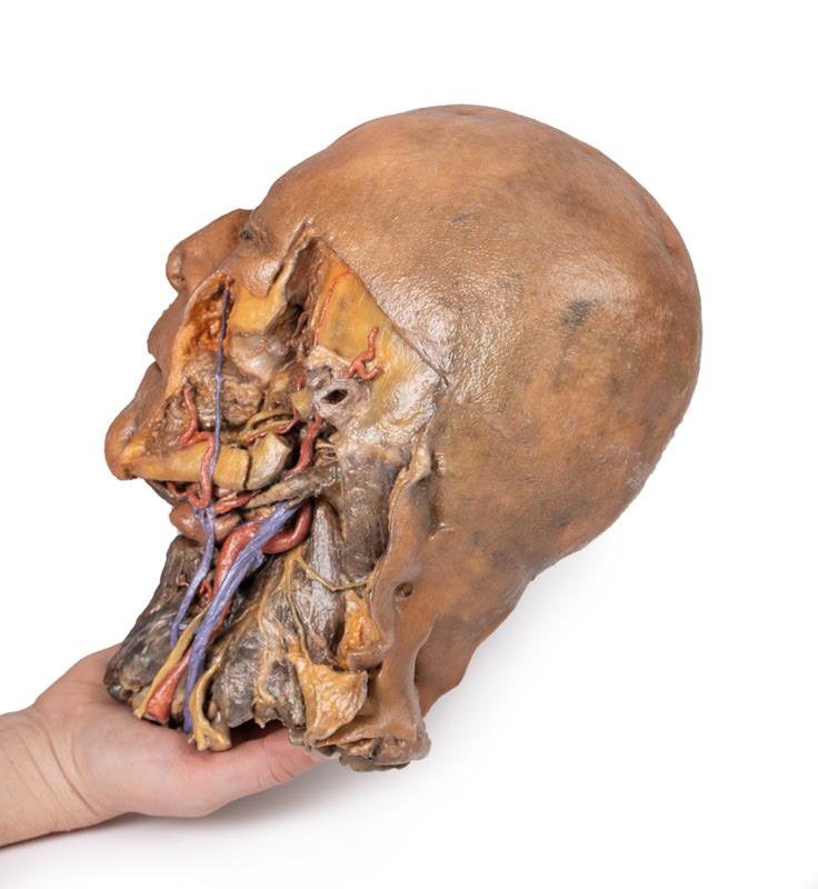 Sagittale Doorsnede Hoofd en Nek met Dissectie, 3D Print