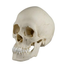 Scaphocephalische Schedel