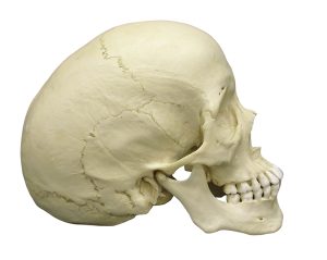 Scaphocephalische Schedel