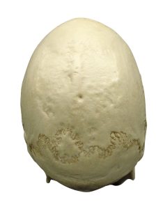 Scaphocephalische Schedel